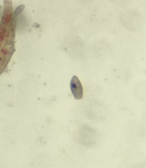 Protozoa