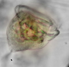 Vorticella