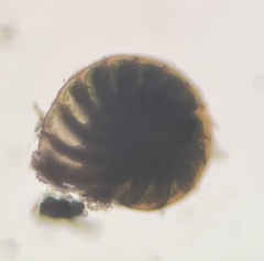 Foraminifera