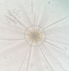 Acanthometridae