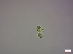 Coelastrum