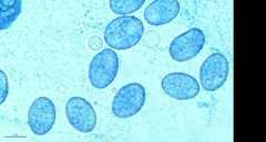 Scutellinia colensoi