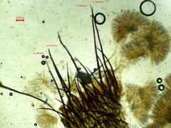 Scutellinia colensoi