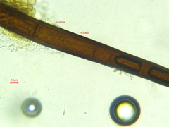 Scutellinia colensoi