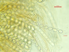 Scutellinia colensoi