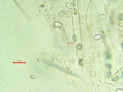Scutellinia colensoi