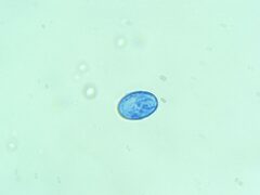 Scutellinia colensoi