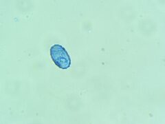Scutellinia colensoi