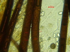 Scutellinia colensoi