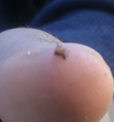 Ostearius melanopygius