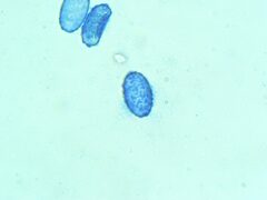 Scutellinia colensoi