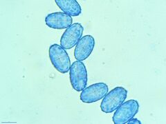 Scutellinia colensoi