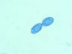 Scutellinia colensoi