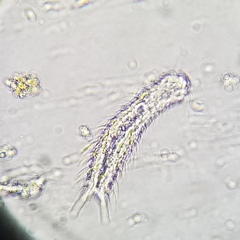 Gastrotricha