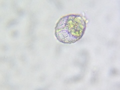 Quadrulella symmetrica