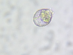 Quadrulella symmetrica