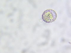 Quadrulella symmetrica