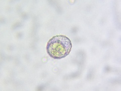 Quadrulella symmetrica