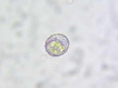 Quadrulella symmetrica