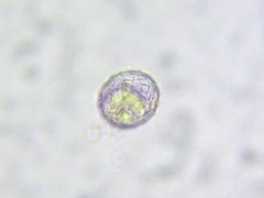 Quadrulella symmetrica