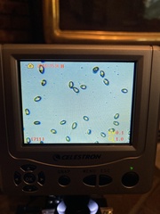 Cortinarius malachius