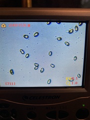 Cortinarius malachius