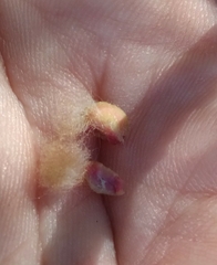 Neuroterus laurifoliae