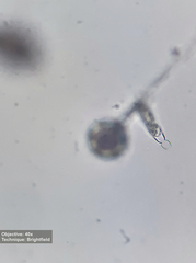 Saprolegniales