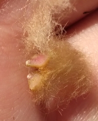 Neuroterus laurifoliae