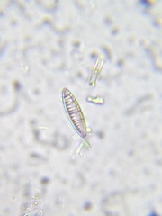 Denticula subtilis