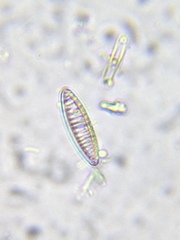 Denticula subtilis