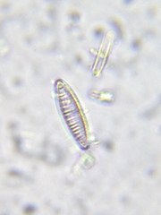 Denticula subtilis
