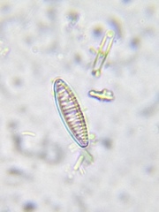 Denticula subtilis