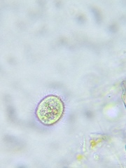 Strobilidium