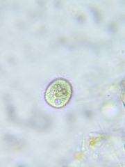 Strobilidium