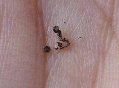 Enchytraeidae