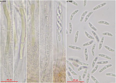 Chlorencoelia versiformis