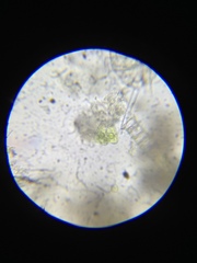 Staurastrum lapponicum