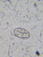 Protozoa