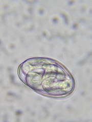 Protozoa