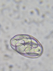 Protozoa