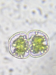 Cosmarium margaritatum