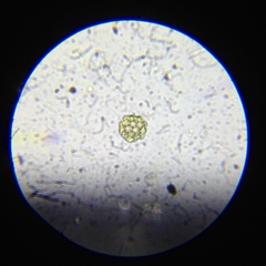 Coelastrum pulchrum