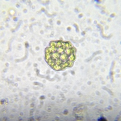Coelastrum pulchrum