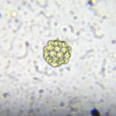Coelastrum pulchrum