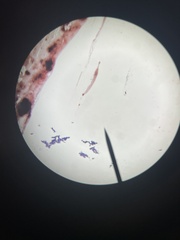Paramecium