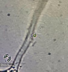 Chlorophyta