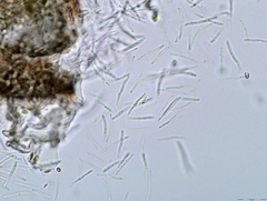 Septoria cymbalariae