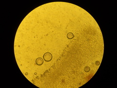 Sistotrema sernanderi