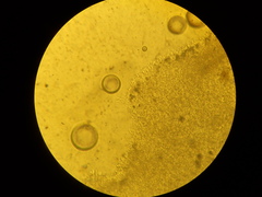 Sistotrema sernanderi